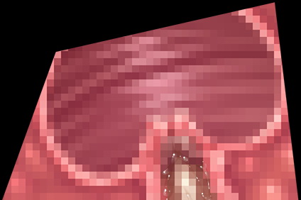 561