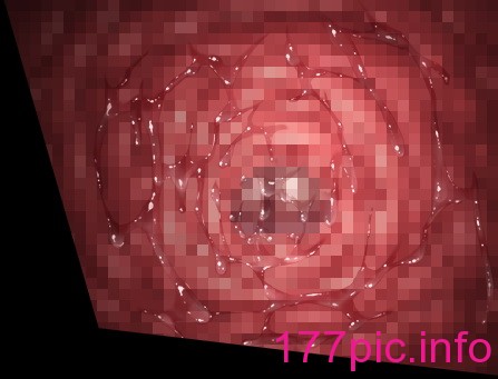 961