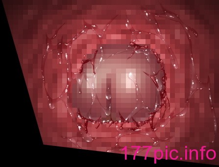 965