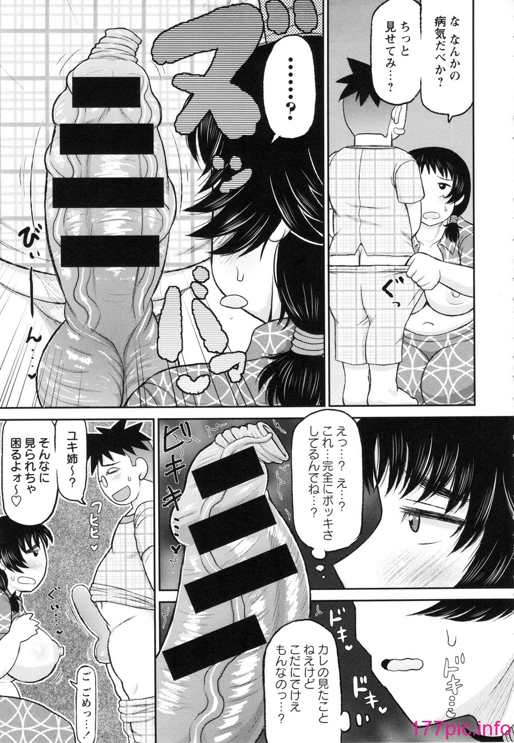 151