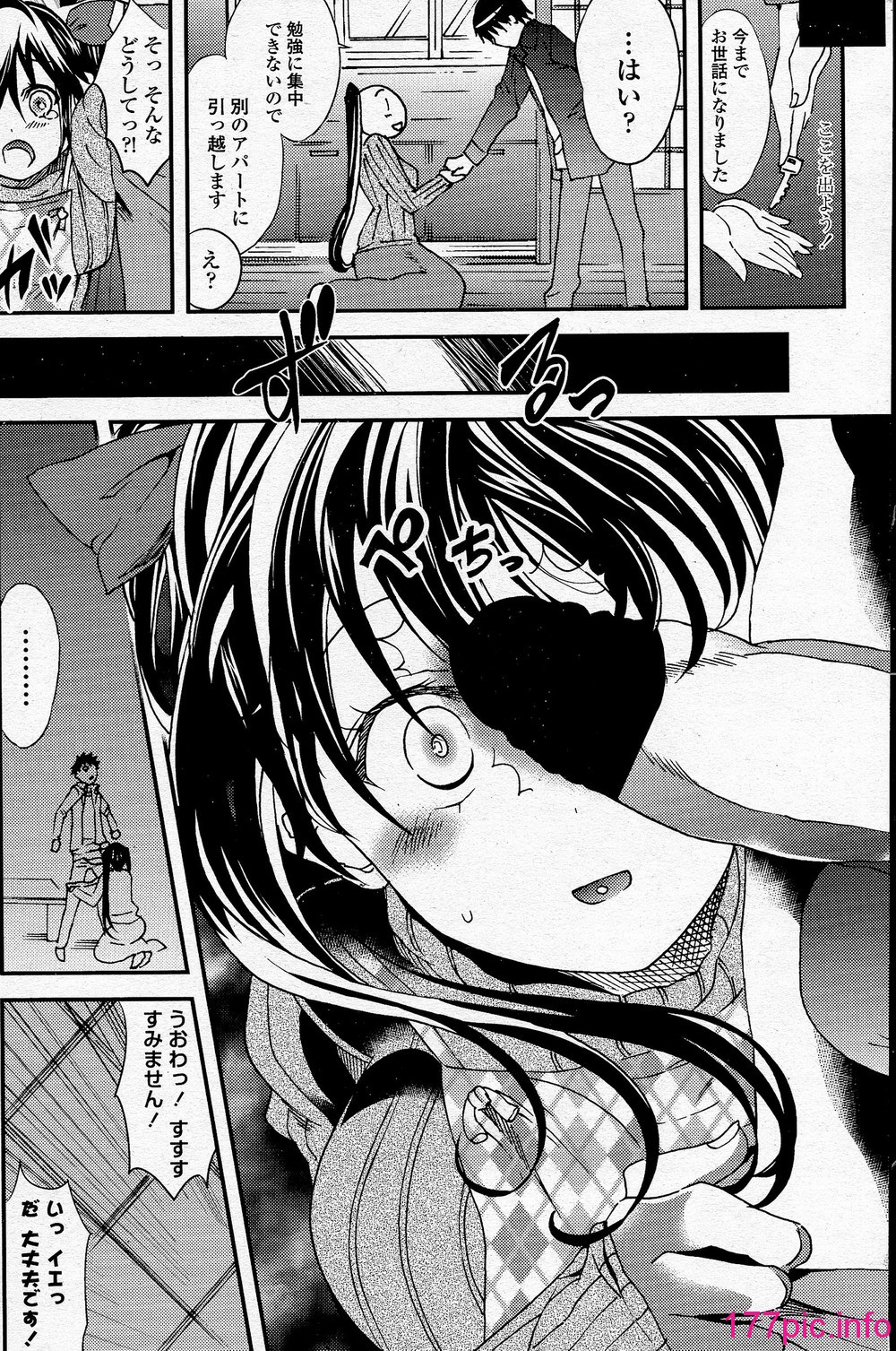 161